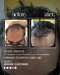 Ultimate Men’s Hair Regrowth Kit