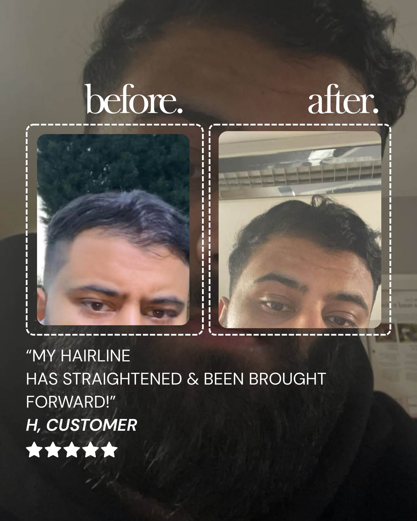 Ultimate Men’s Hair Regrowth Kit