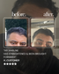 Ultimate Men’s Hair Regrowth Kit