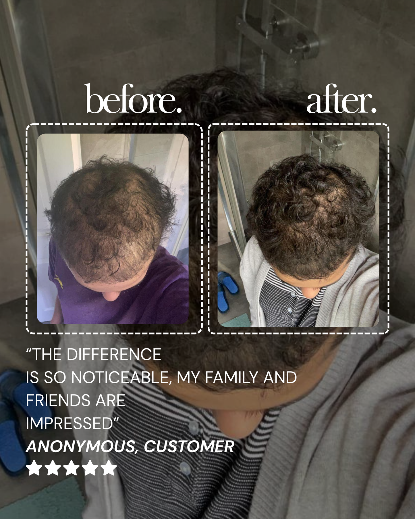 Ultimate Men’s Hair Regrowth Kit