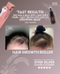 Pink Hair Growth Roller (Dermaroller 1.0mm)