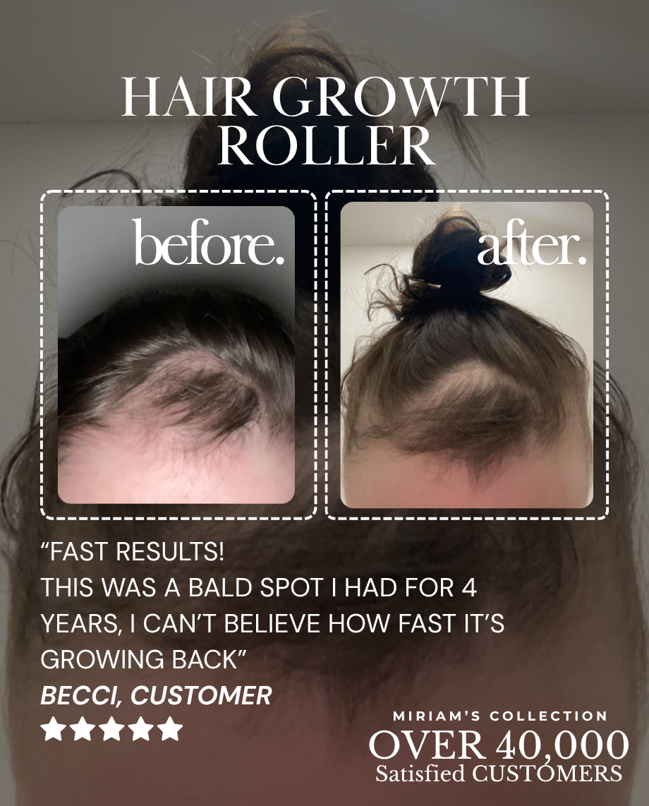 Pink Hair Growth Roller (Dermaroller 1.0mm)