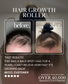 Pink Hair Growth Roller (Dermaroller 1.0mm)