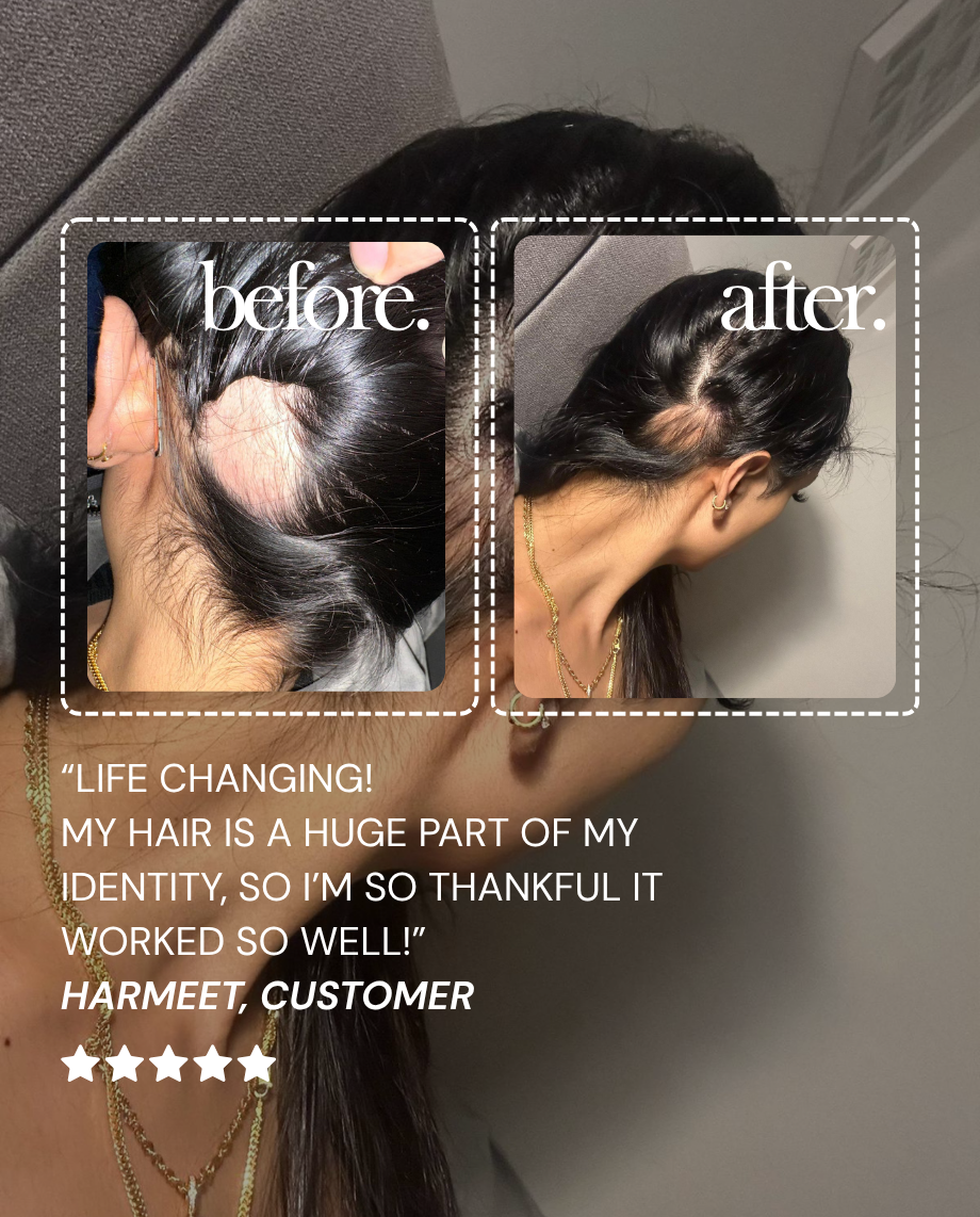 Hair Growth Bundle