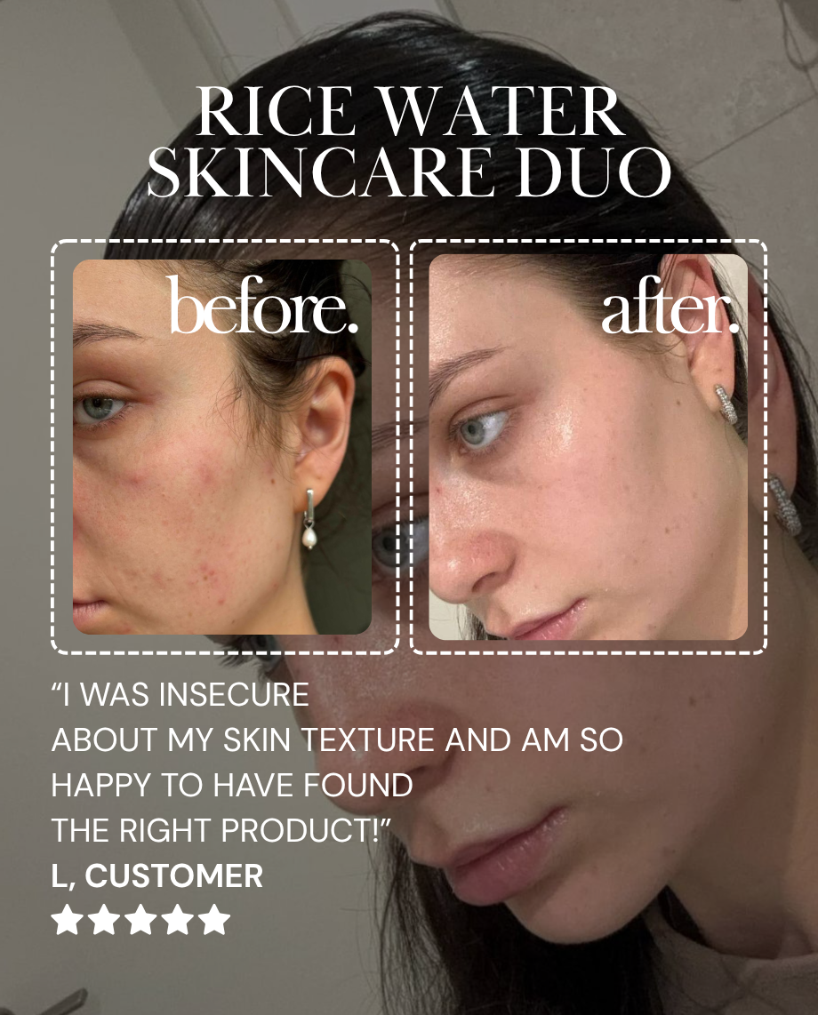 Rice Water Skincare Duo