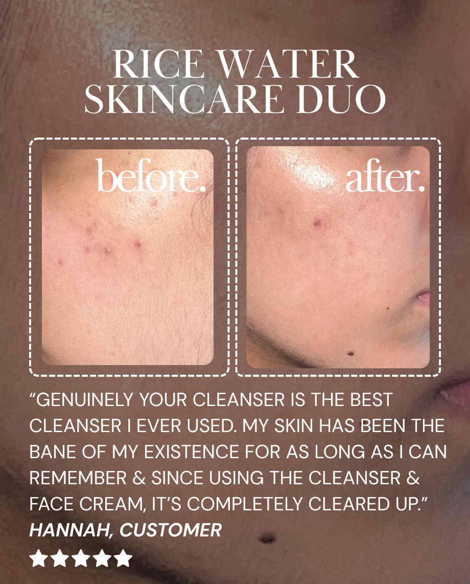 Rice Water Skincare Duo
