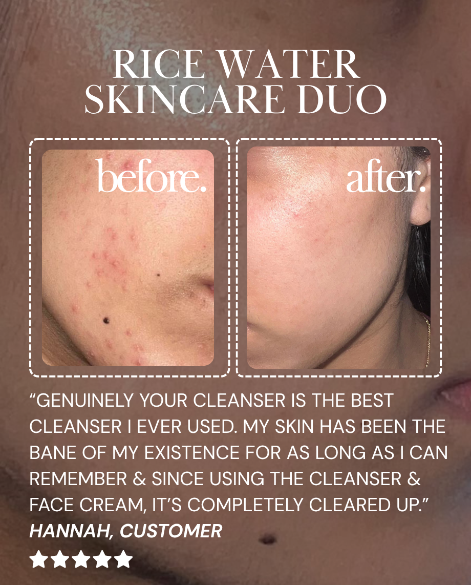 Rice Water Skincare Duo